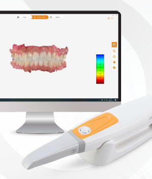 Intra Oral Scanner