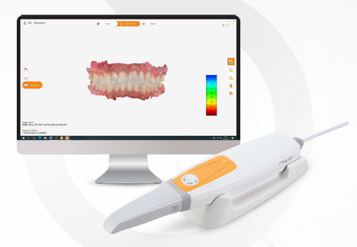 Intra Oral Scanner